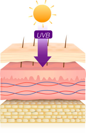 Rayos UVB