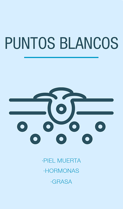 Puntos blancos