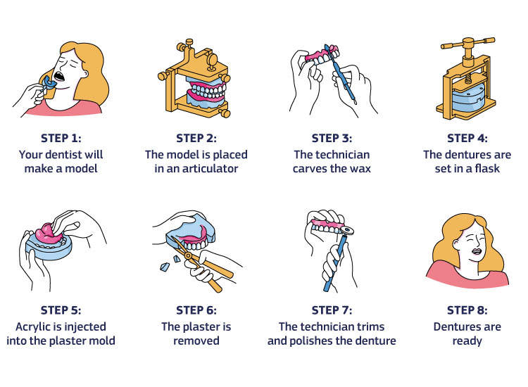 Denture making process: The dentist will make a model and place it in an articulator. The wax is carved. Dentures are set in a flask. Acrylic is injected into the plaster mold. The plaster is removed. As the last step, dentures are trimmed and polished.