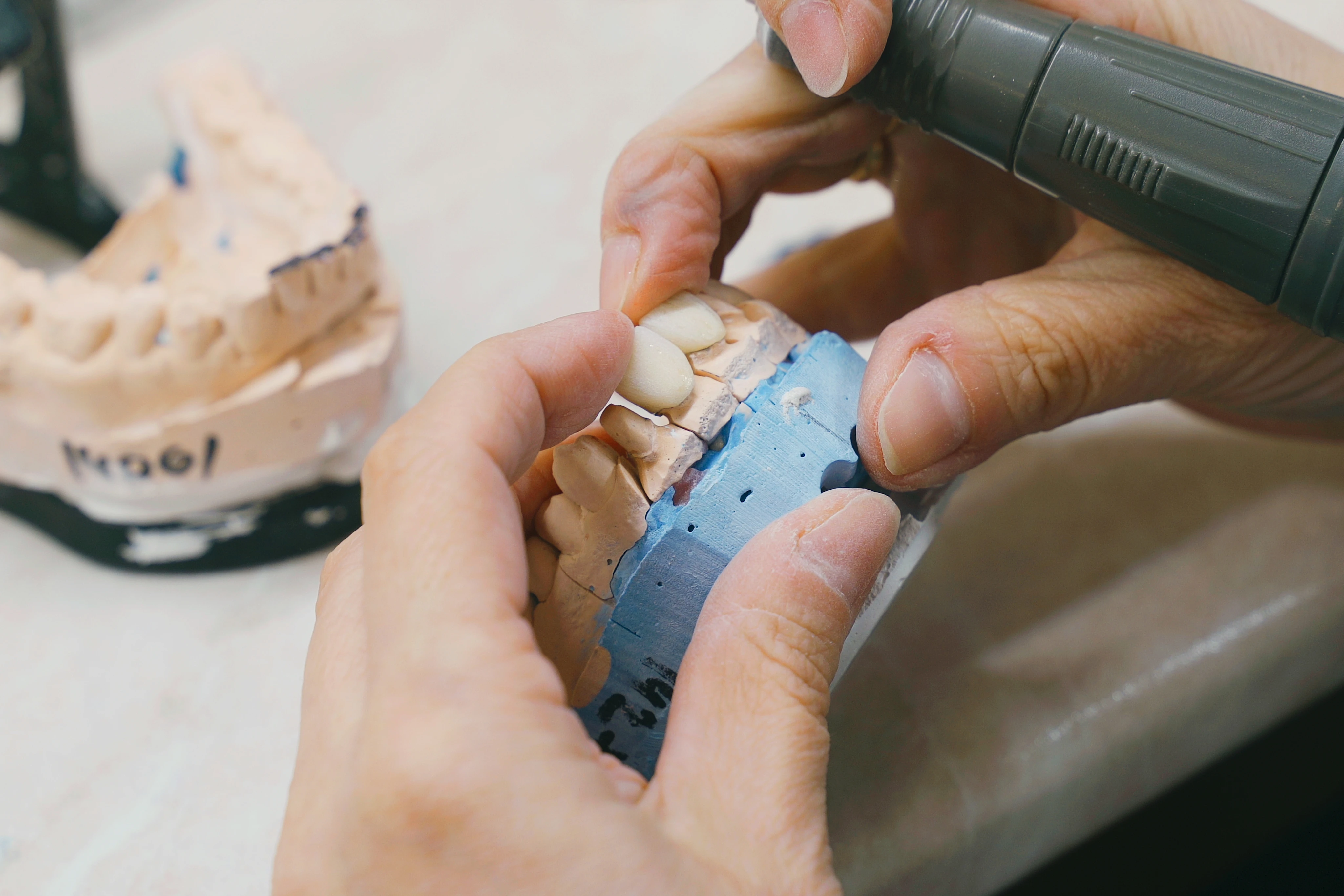 Prothesis rehabilitation