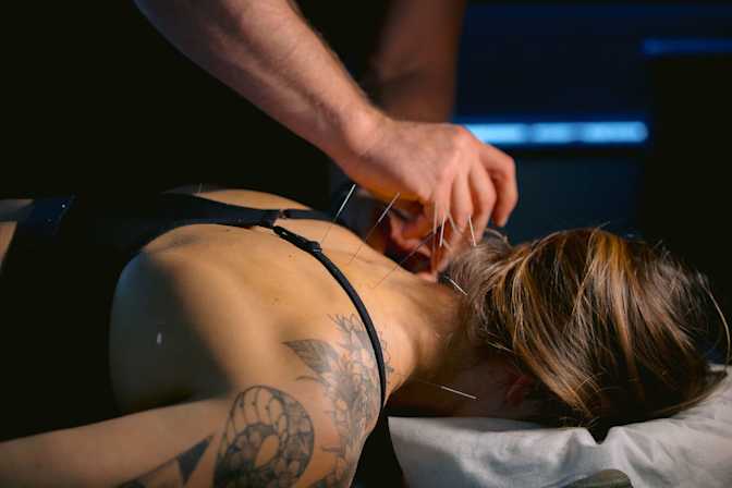 What Is Sports Medicine Acupuncture®?