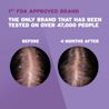 Rogaine-EDIS-R-BeforeAfter-WomansTopical-EDI.webp