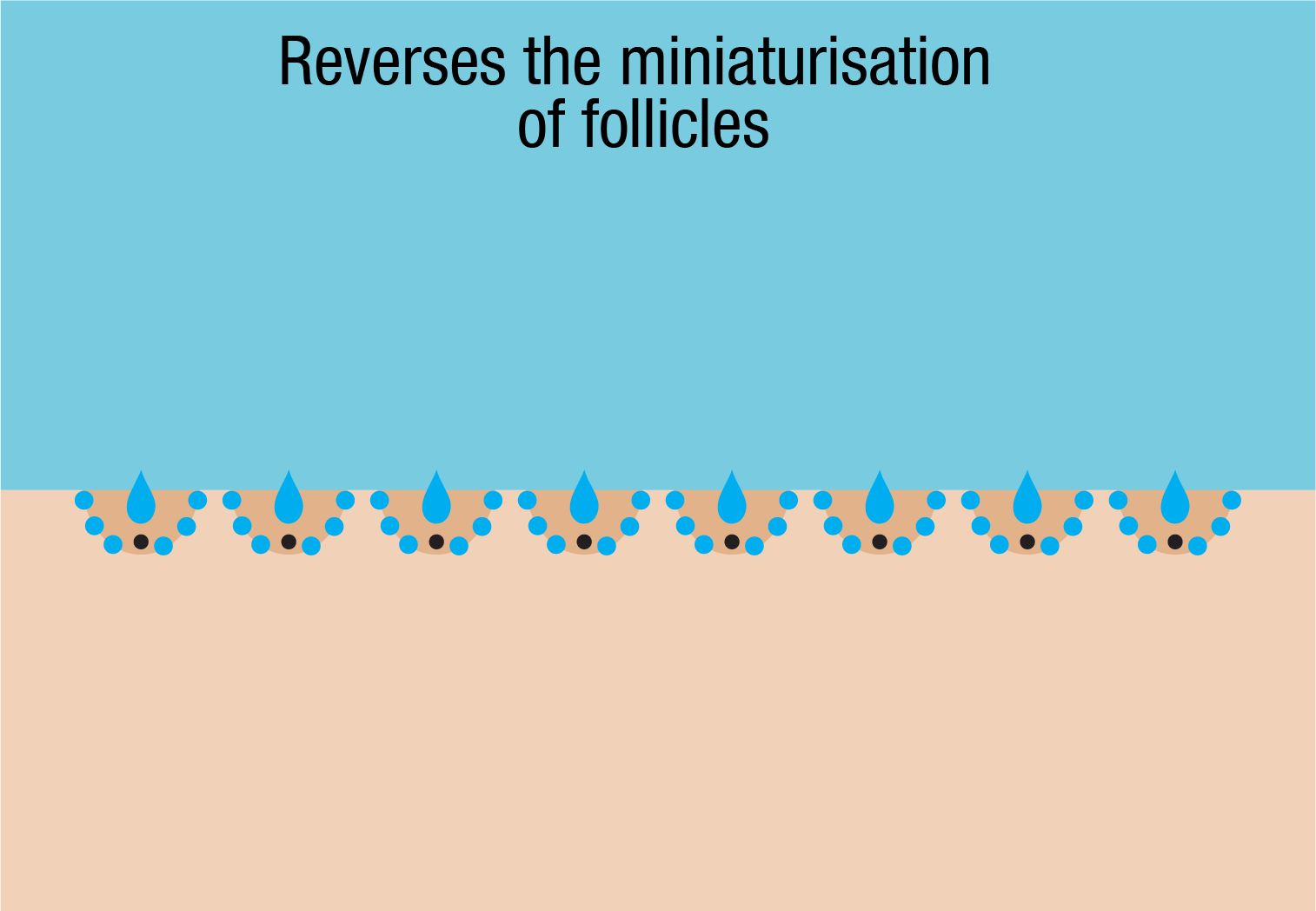 Minaturised hair follicles