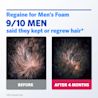 REGAINE® FOR MEN EXTRA STRENGTH SCALP FOAM FOR HAIR REGROWTH