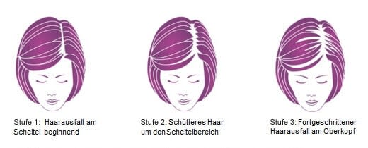 visual haarausfall consumer women