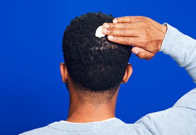 Back of a man’s head while applying men’s Rogaine Foam on a blue background. Back of a man’s head while applying men’s Rogaine Foam on a blue background.