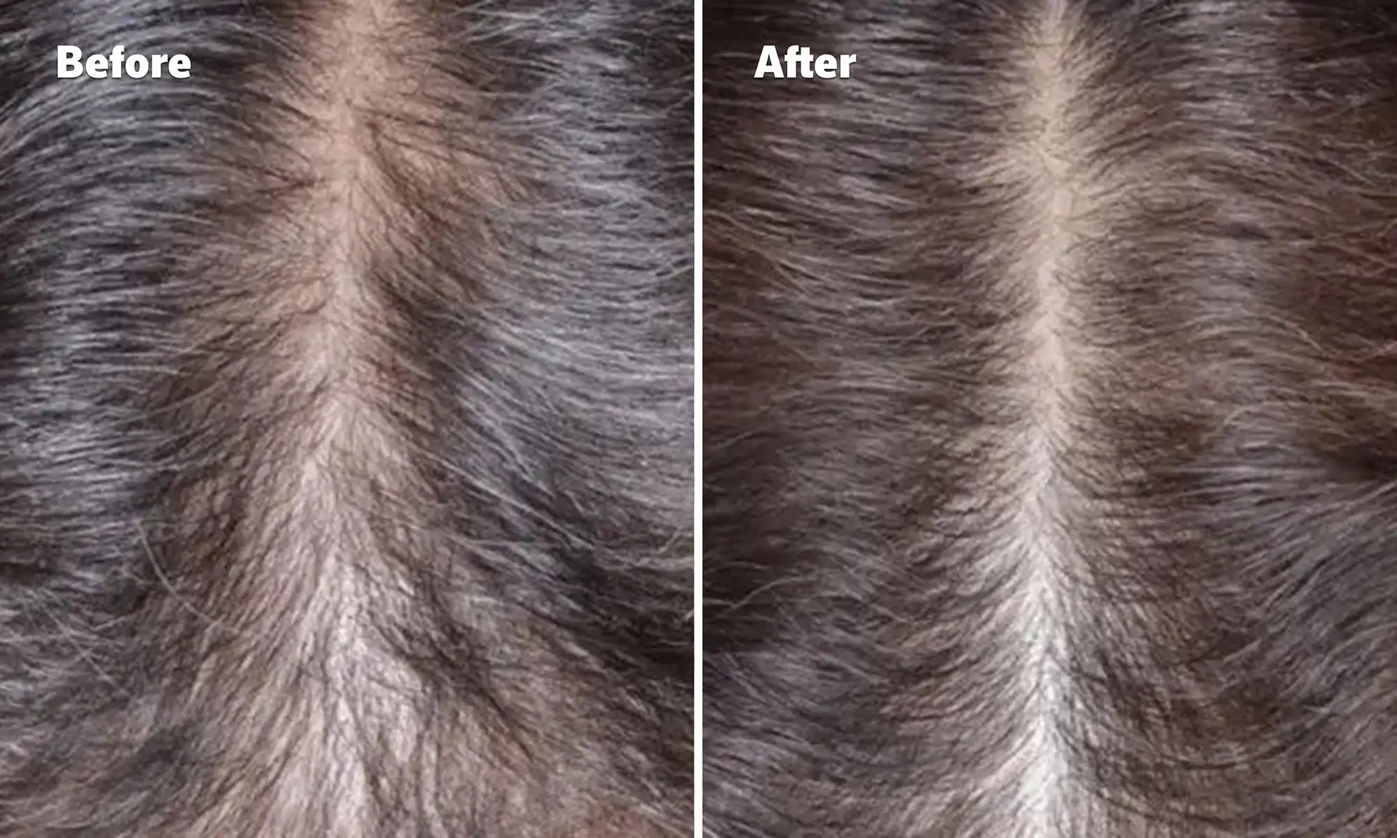 Before and After image, top of woman's scalp showing signs of hair regrowth. Before and After image, top of woman's scalp showing signs of hair regrowth.