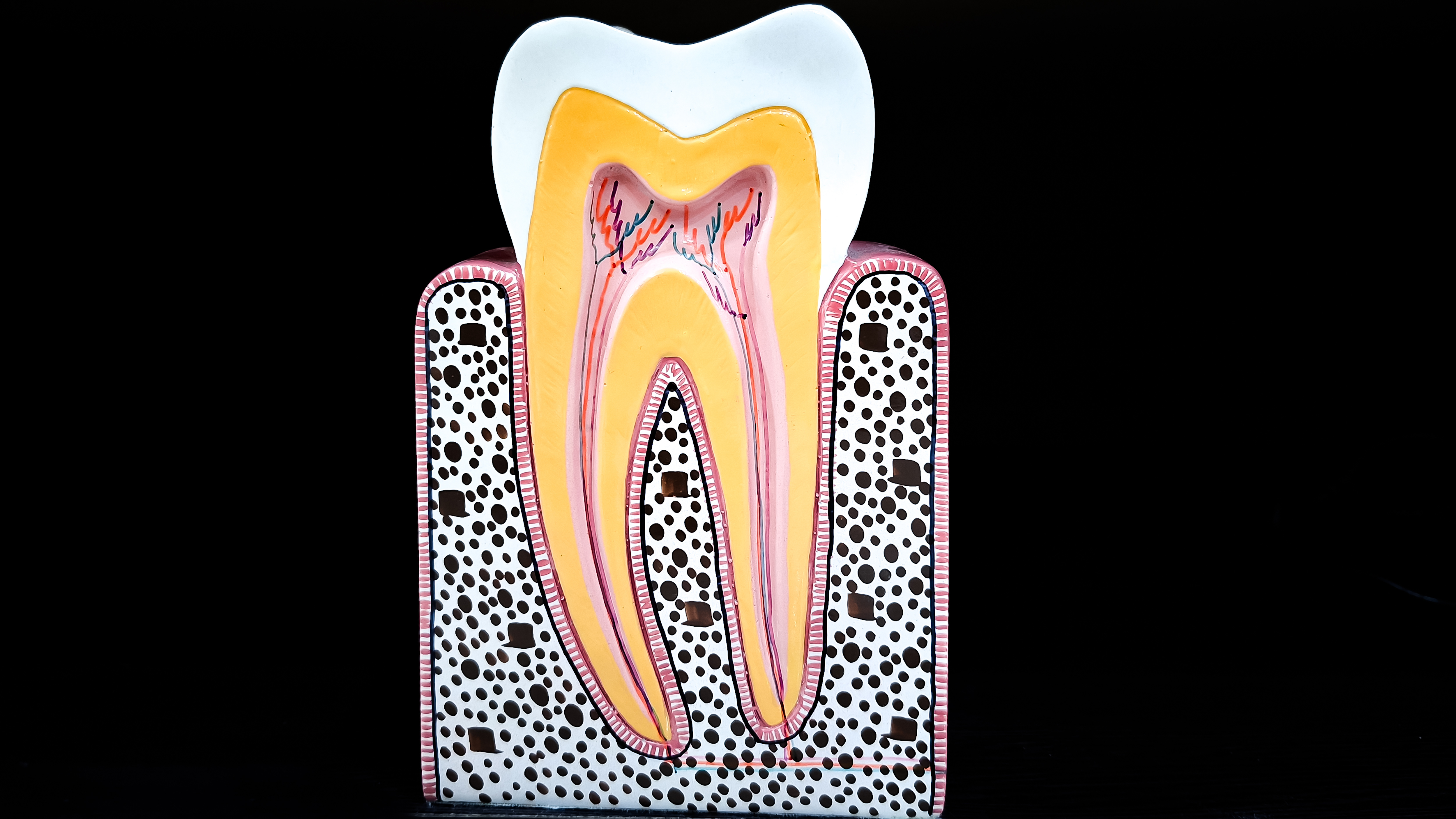 Image showing a cross section of tooth with enamel, dentin, and pulp | Crest