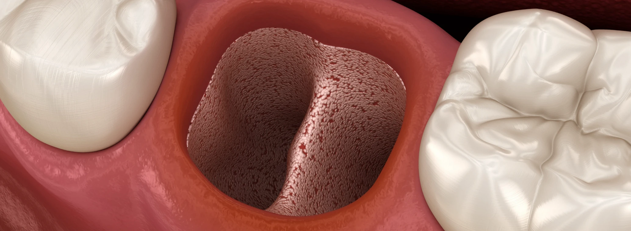 Visual depiction of healthy gums versus unhealthy gums