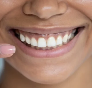 What do Healthy Gums Look Like?