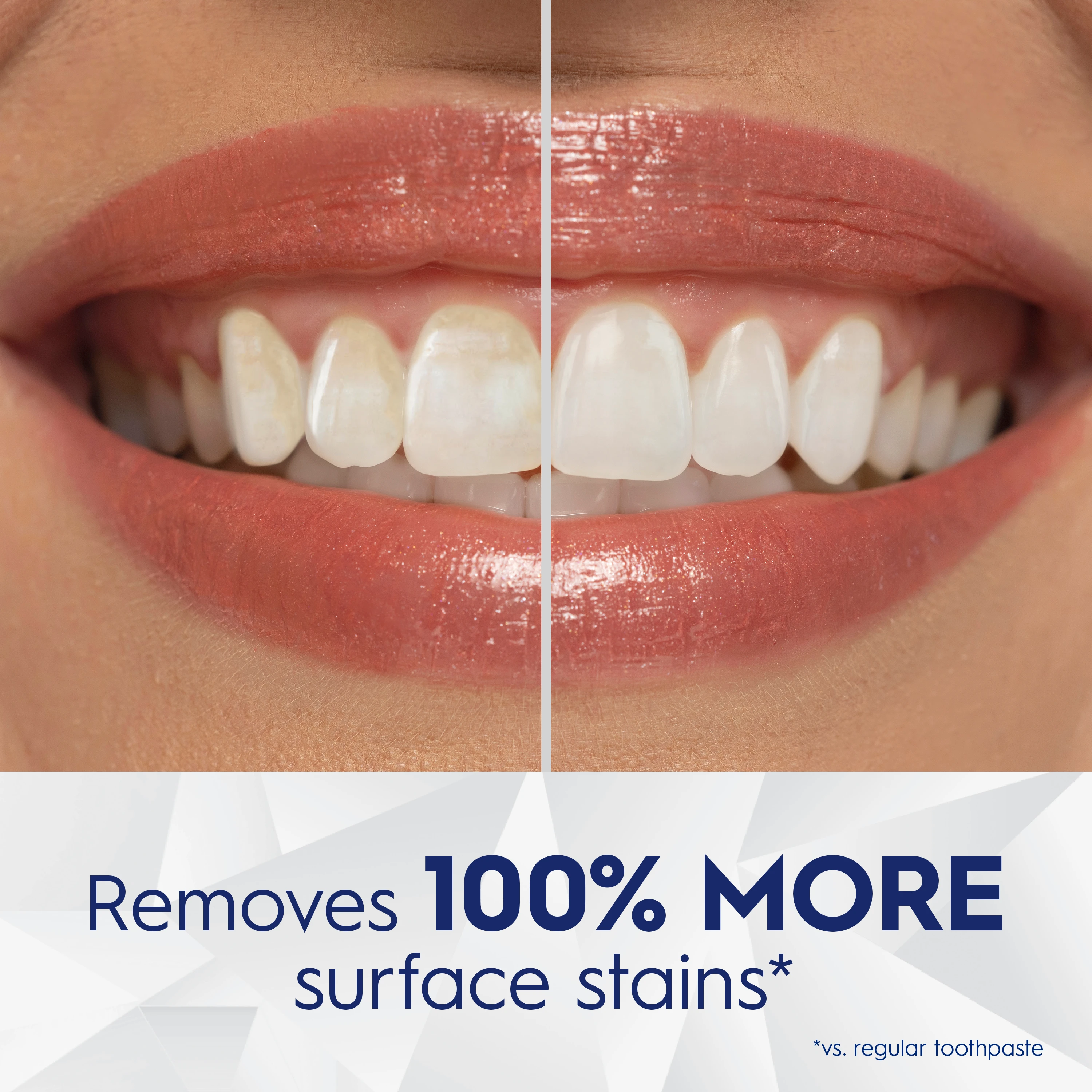 Side by Side image of teeth. Removes 100% more surface stains vs. regular toothpaste