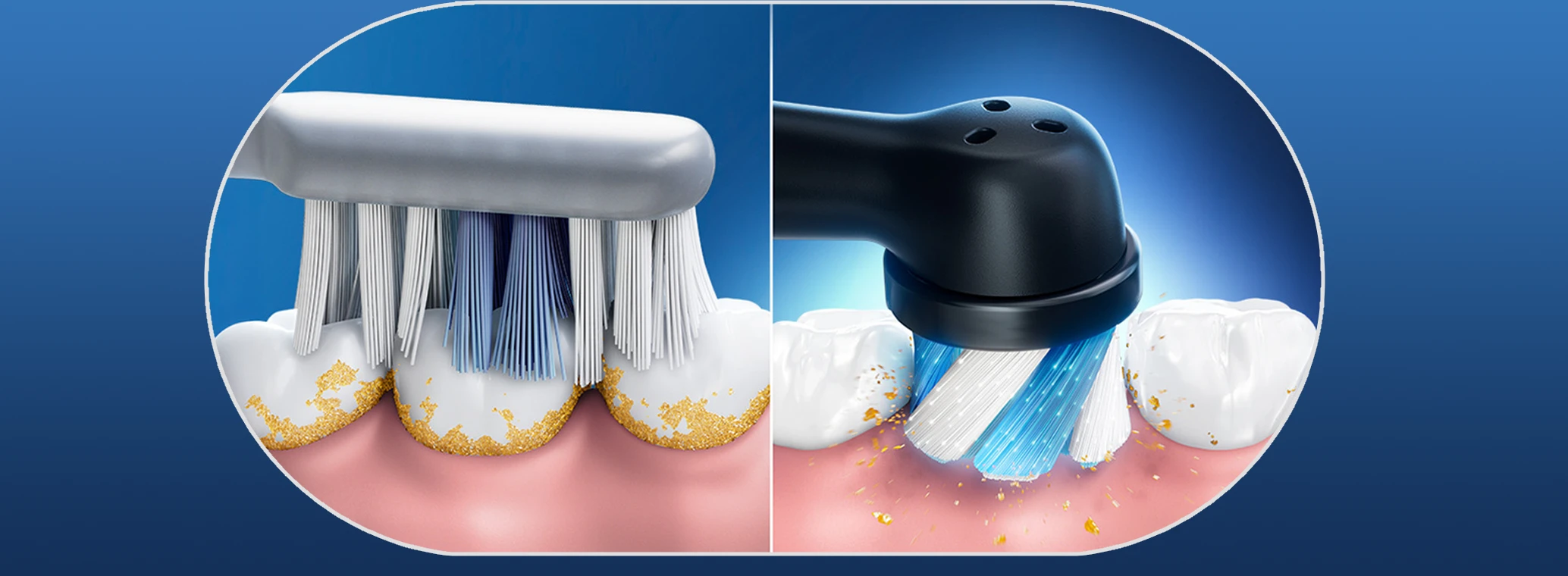 Electric toothbrush vs. manual toothbrush visual comparison, showing superior cleaning efficacy of an electric toothbrush