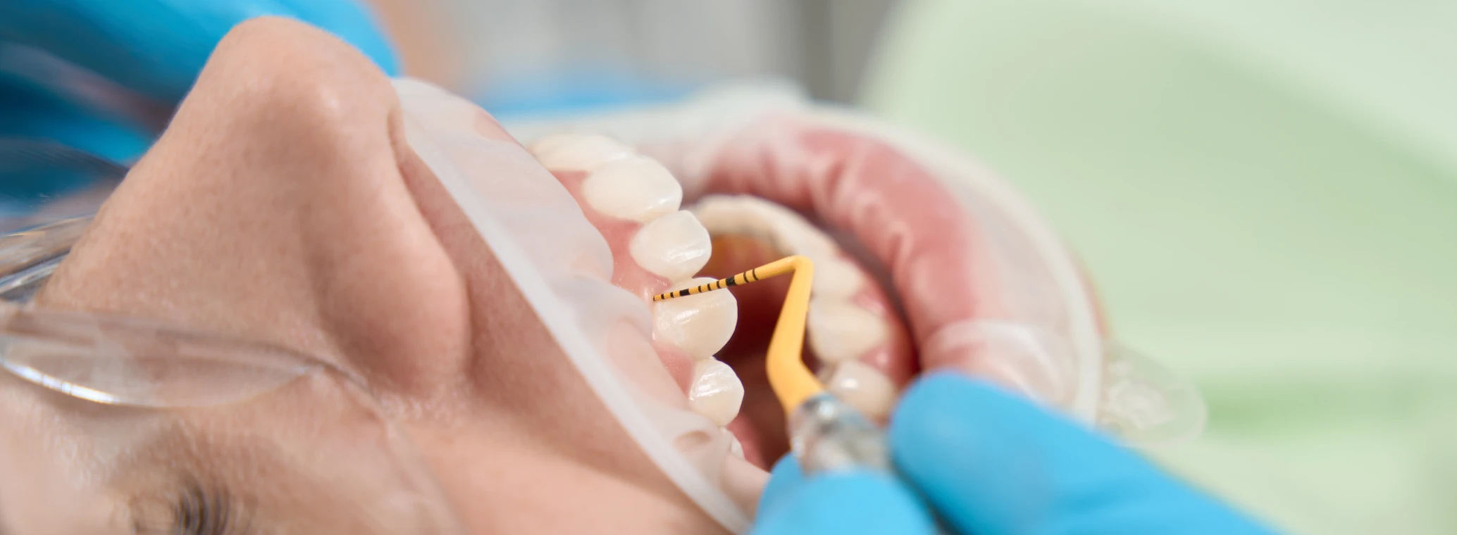 Experienced hygienist in nitrile gloves performing dental scaling on client