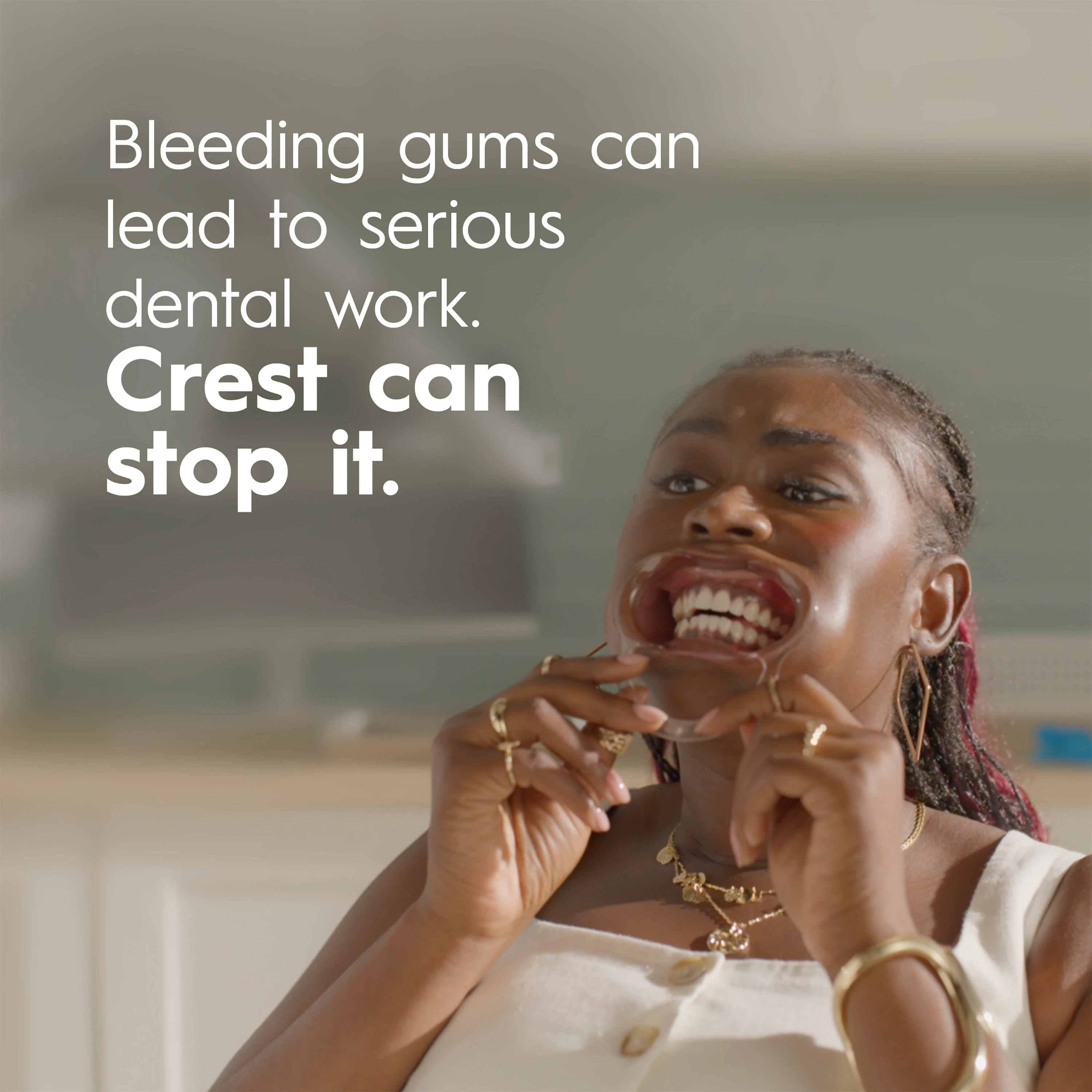 Bleeding gums can lead to serious dental work. Crest can stop it