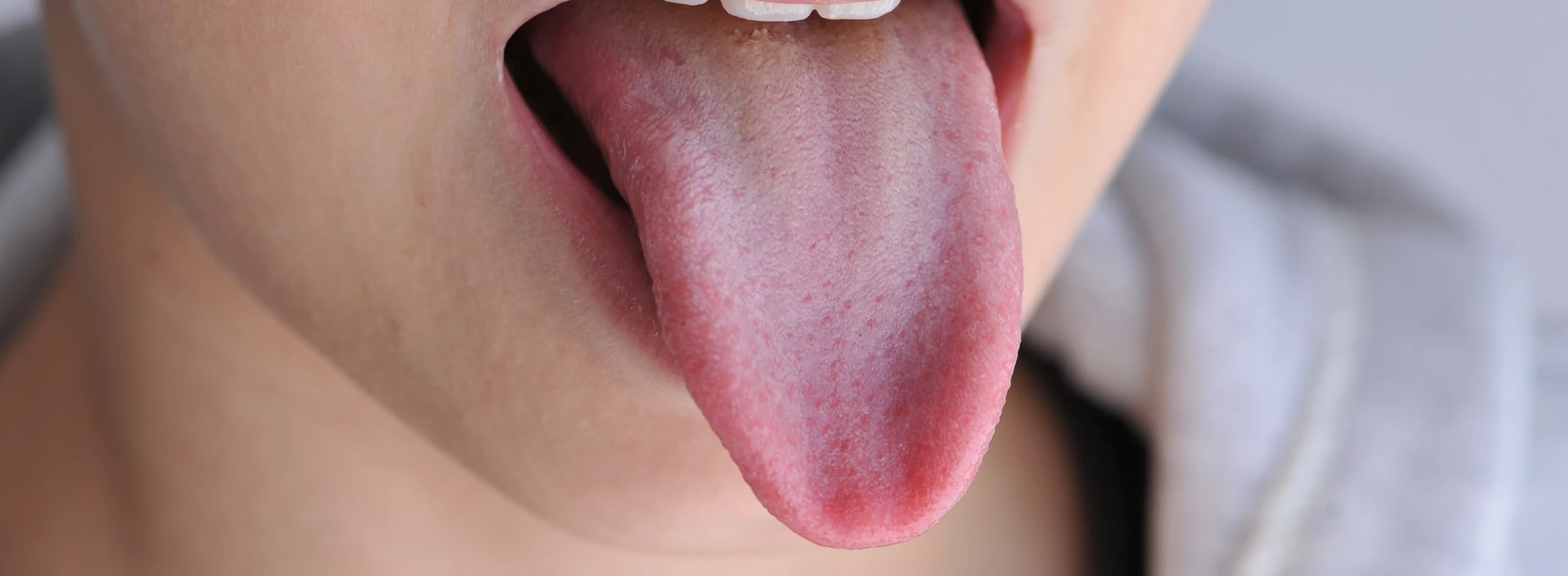 Young boy sticking his tongue out.
