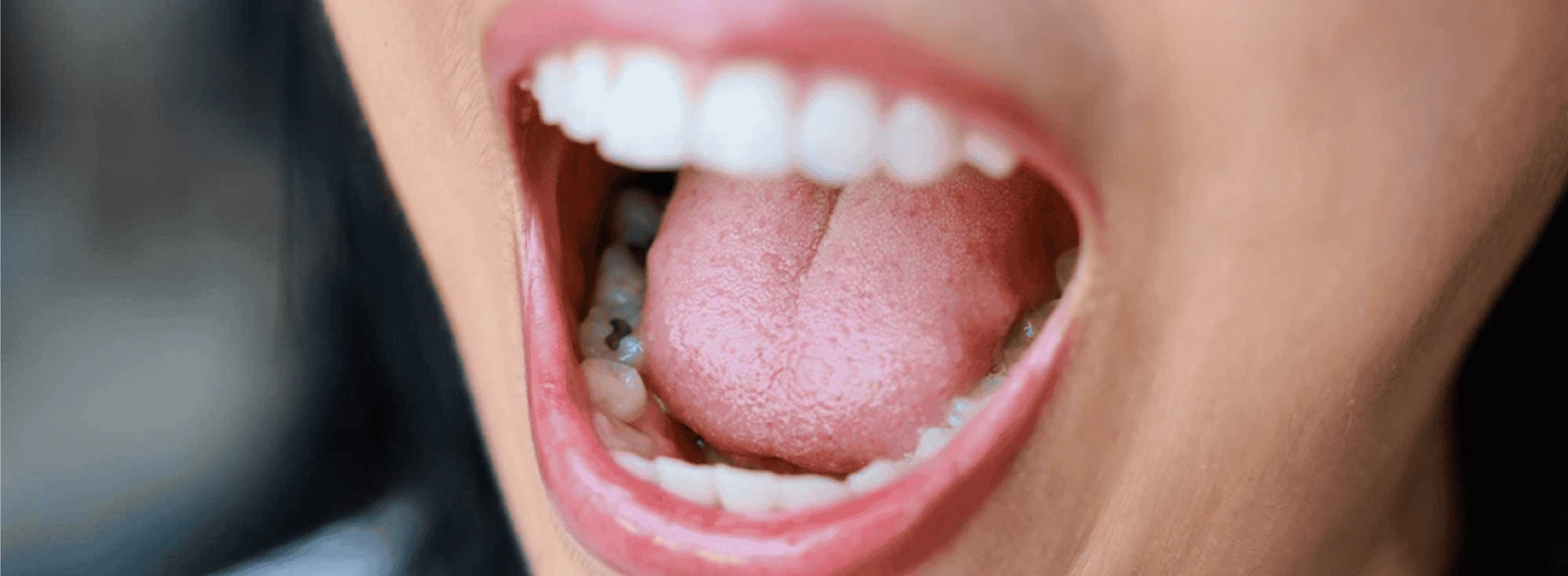 Close-up pf a person with their mouth wide open showing teeth and tongue 