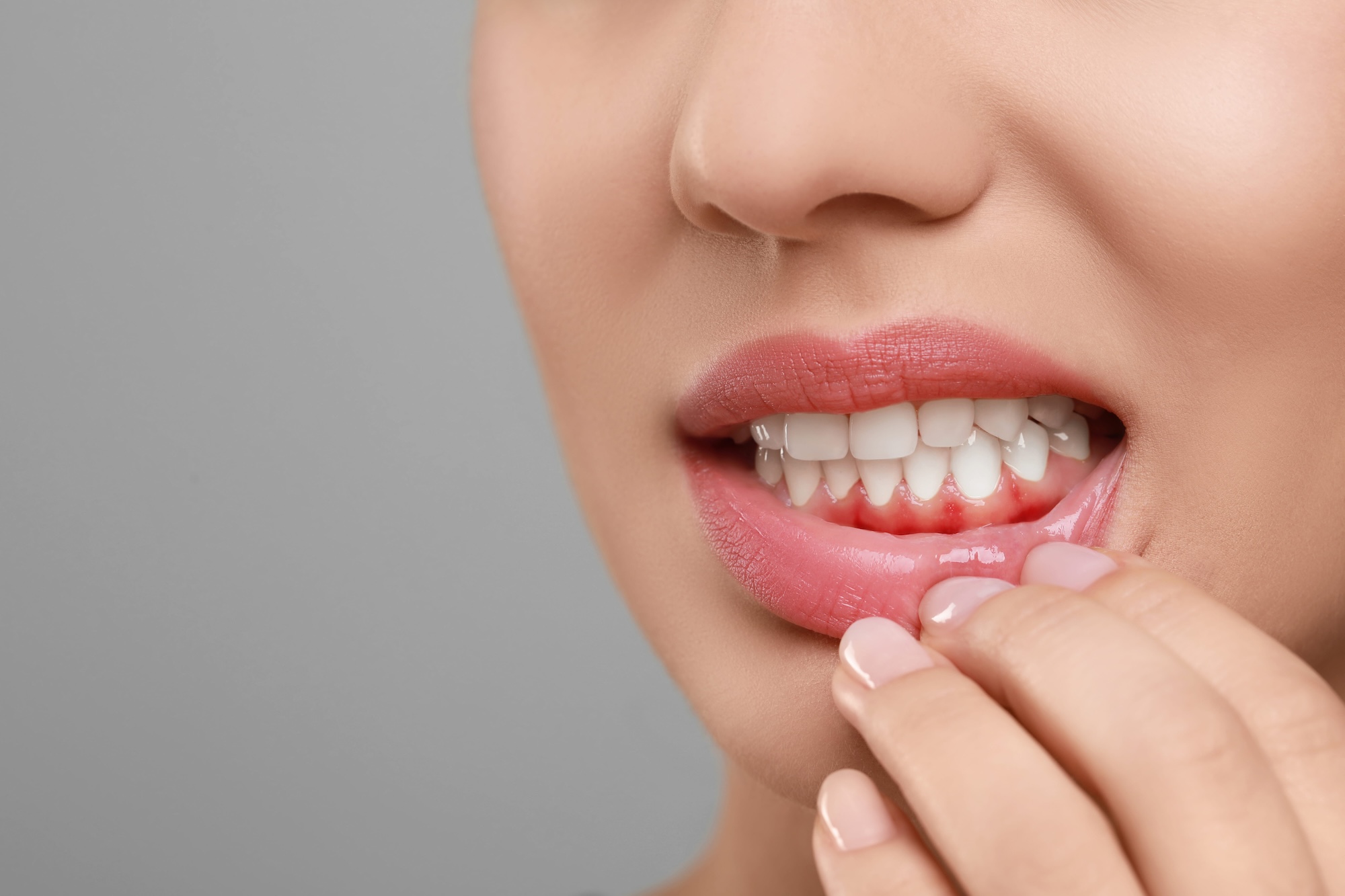 gum-inflammation-cropped-shot-of-a-young-woman-showing-red-bleeding-gums-isolated-on-a-white-background-close-up-dentistry-dental-care