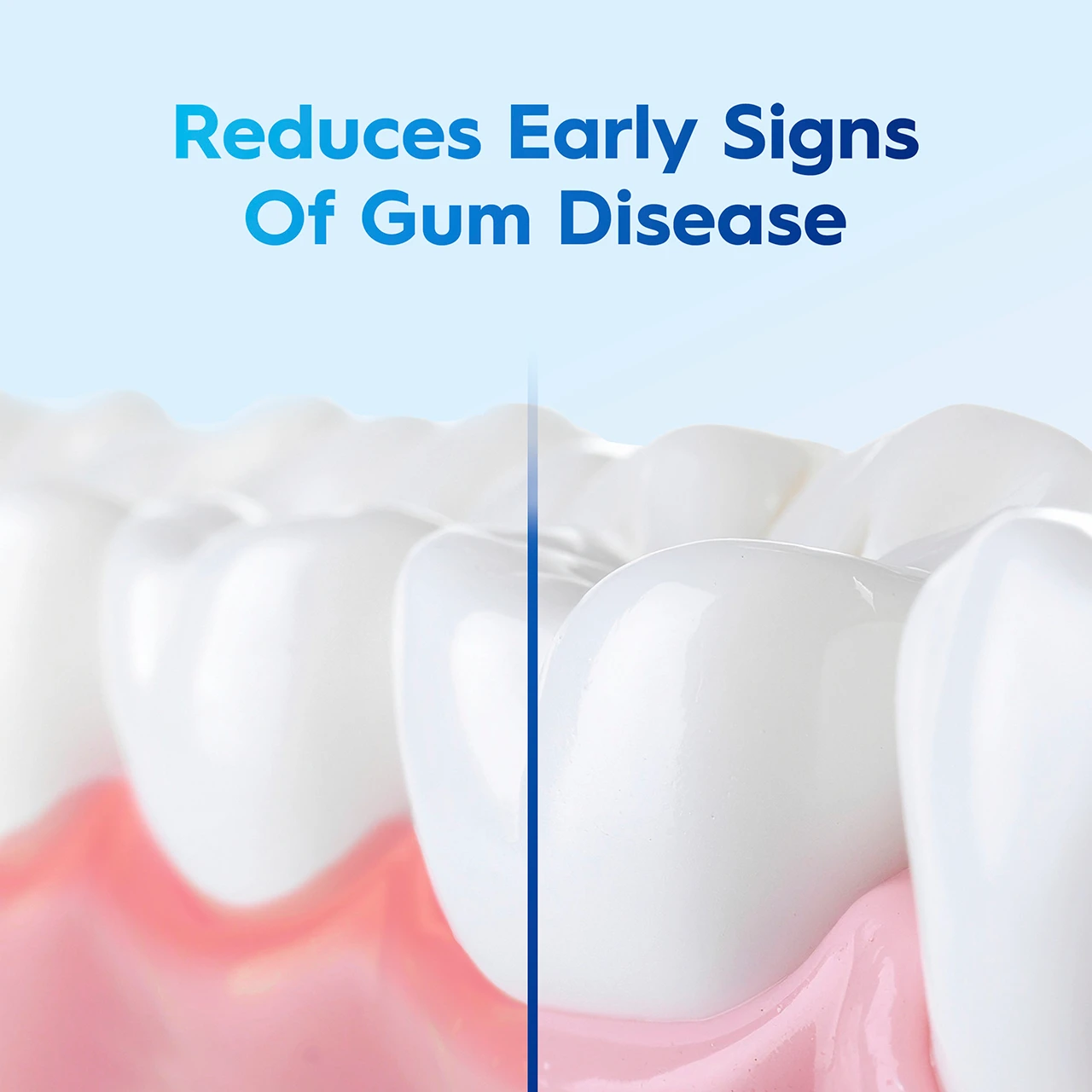 Reduces early signs of gum disease