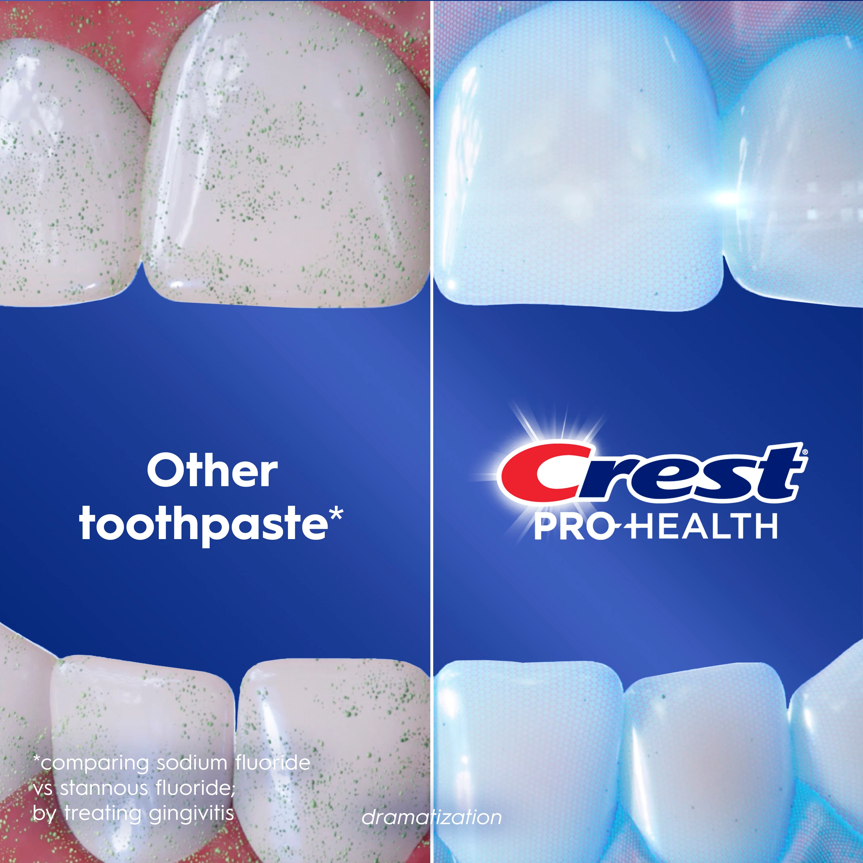 Other toothpaste vs Crest Pro-Health