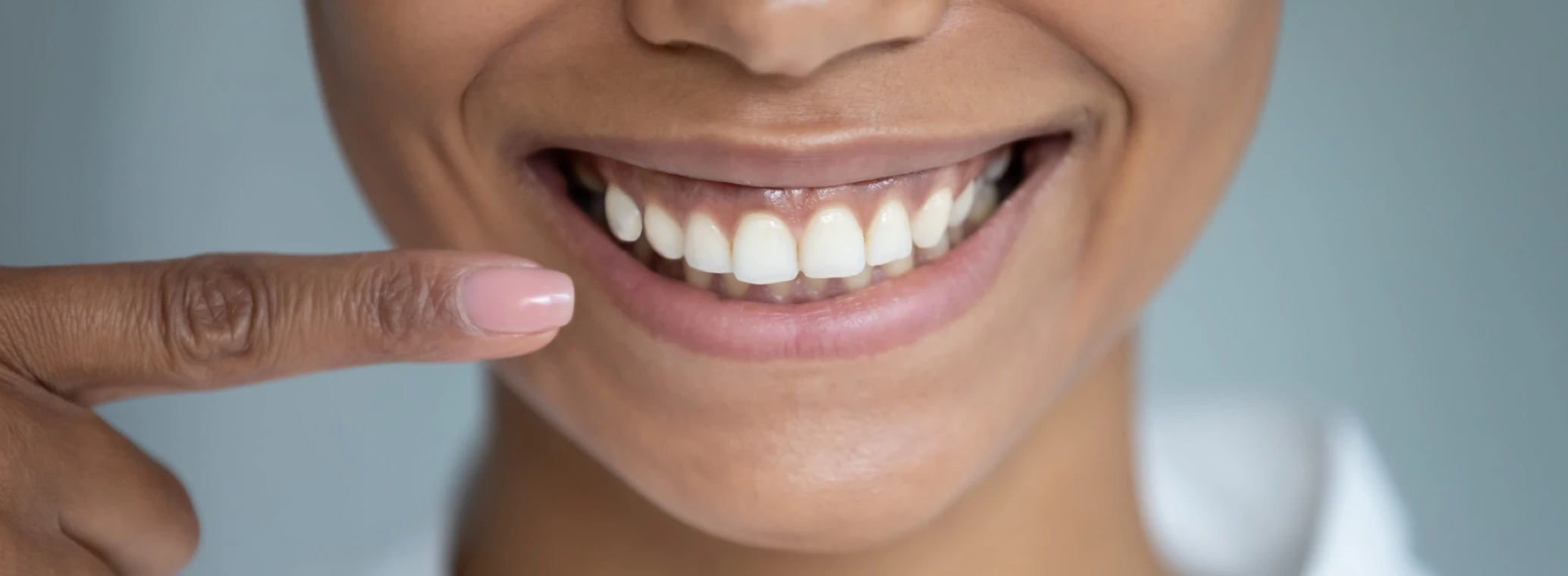  Image of healthy gums I Crest