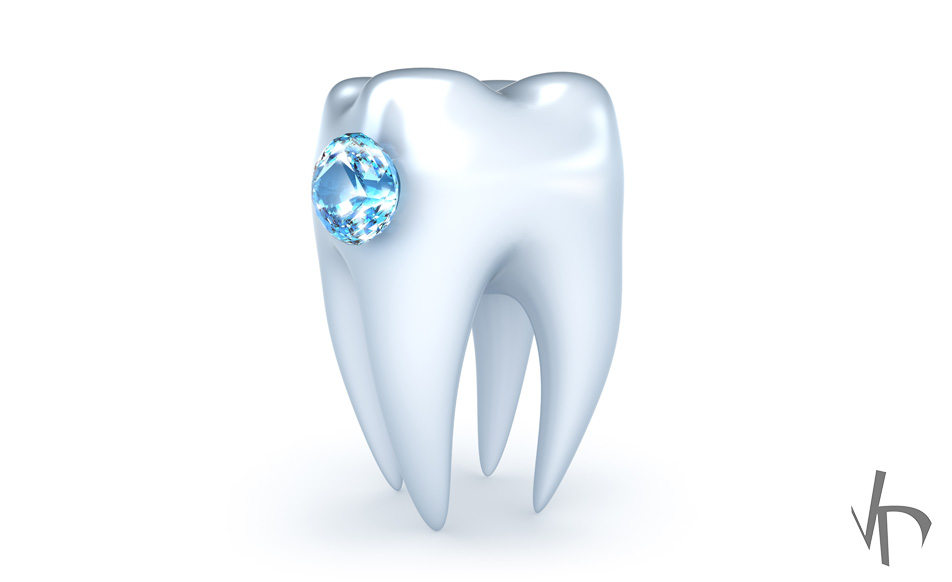 What Types Of Tooth Jewelry Are There Vdm Dental Blog Ny 10014