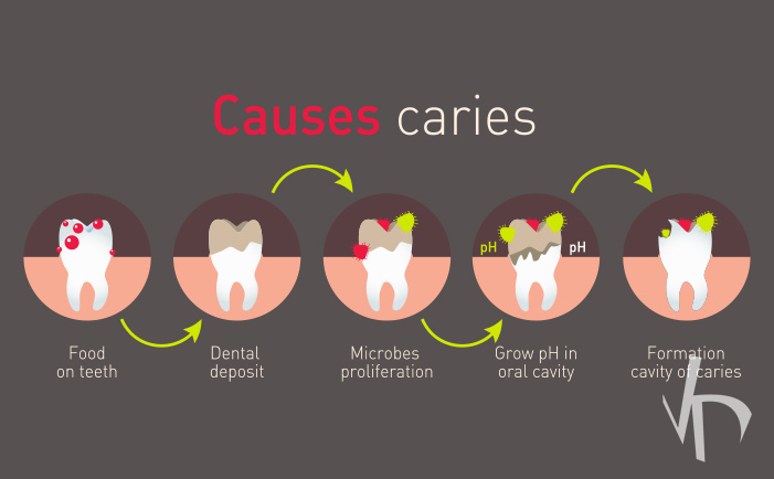 What Are The Reasons Of Caries Becoming So Rampant Vdm Dental Blog Ny