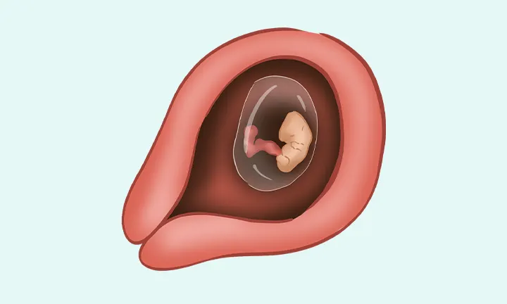 À quoi ressemble un embryon à 4 semaines de grossesse