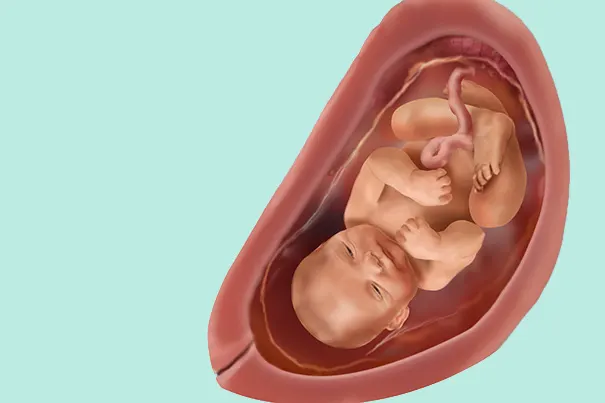 Quel aspect aura bébé à sa naissance ?