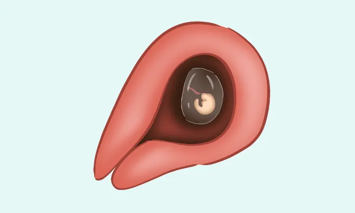 À quoi ressemble un embryon à 2 semaines de grossesse