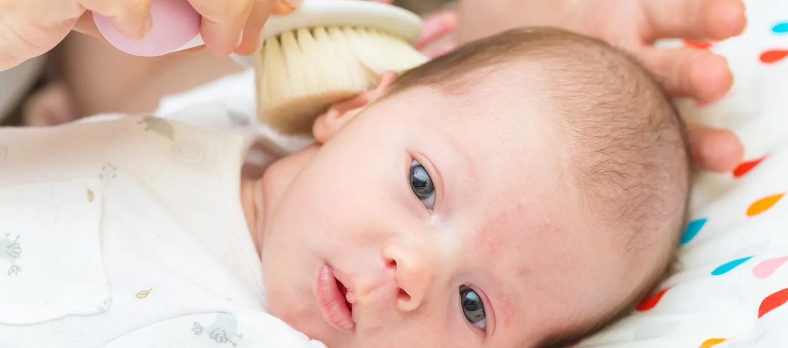 Bébé présentant des croûtes de lait