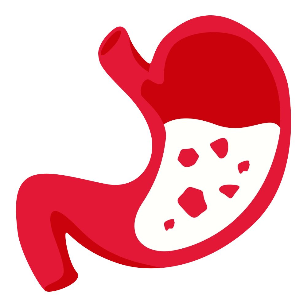 Vomiting or diarrhea (more common in children)