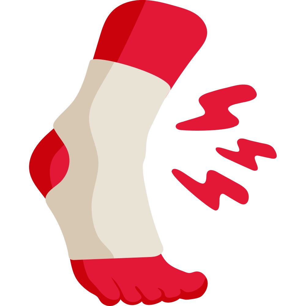 Sprain