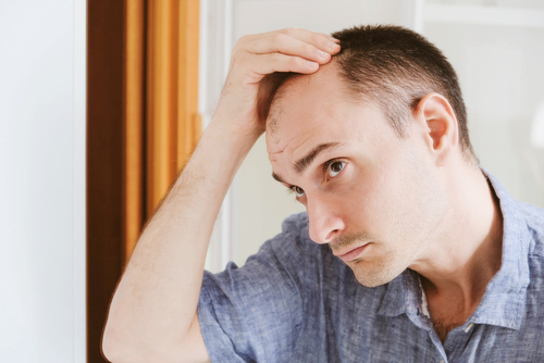 Man examining his hair loss