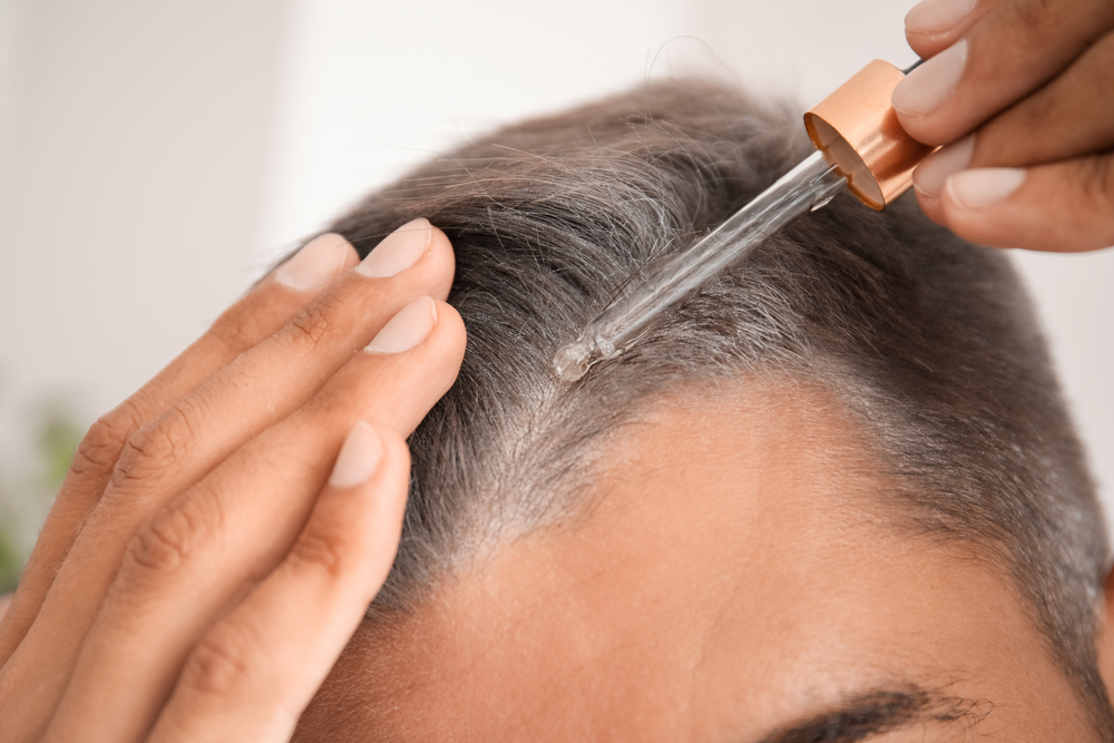 Man applying topical hair treatment