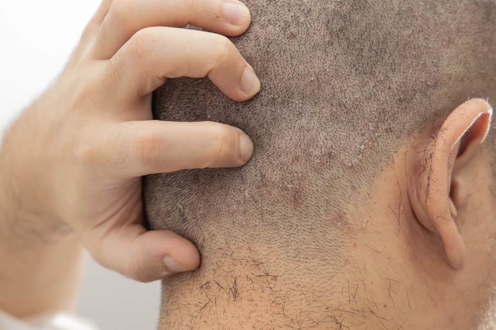 Itchy Scalp And Hair: What's The Link?