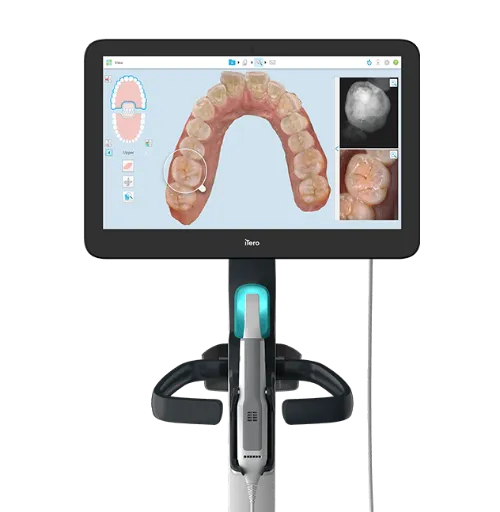 Próteses Dentárias com Impressão 3D: Precisão, Rapidez e Estética