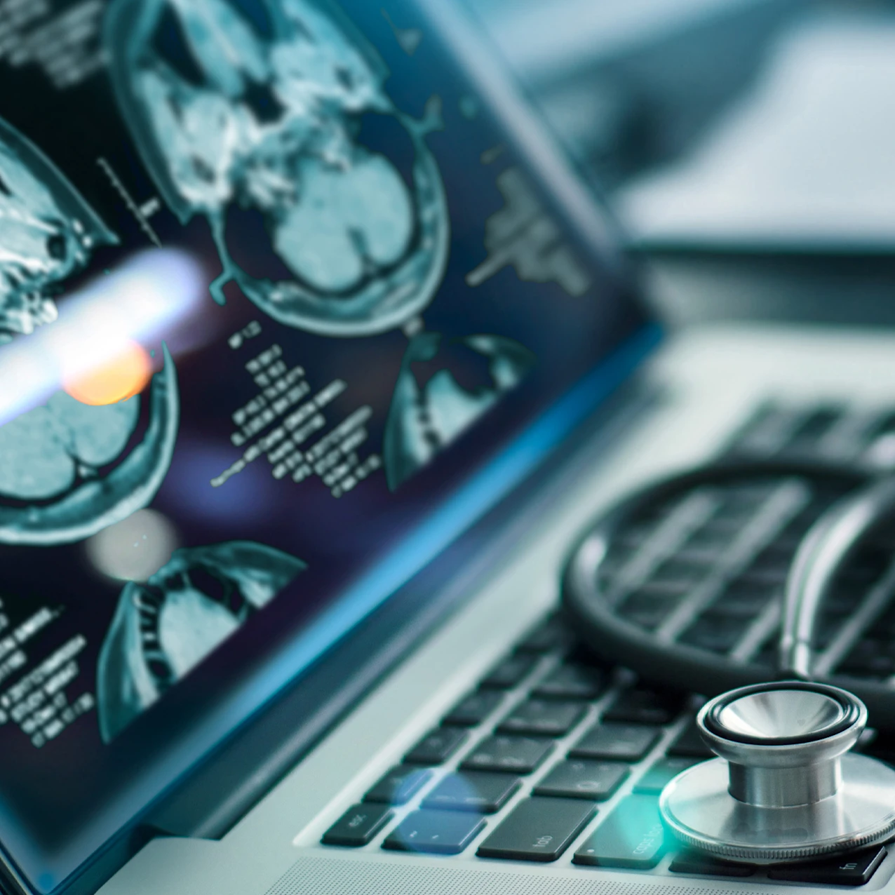 Stethoscope on laptop with brain scans on the screen