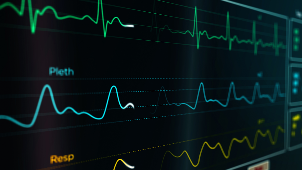 Screen of Pulse Oximeter waveform