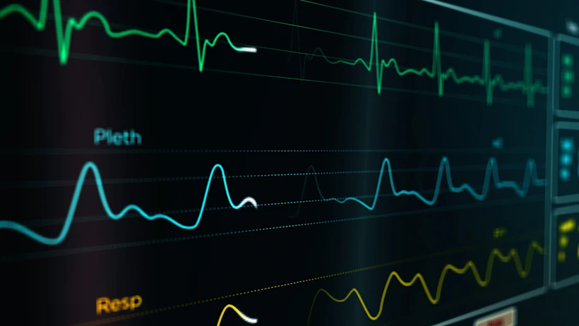 Screen of Pulse Oximeter waveform