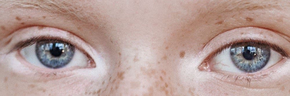The Everything Guide To Undereyes
