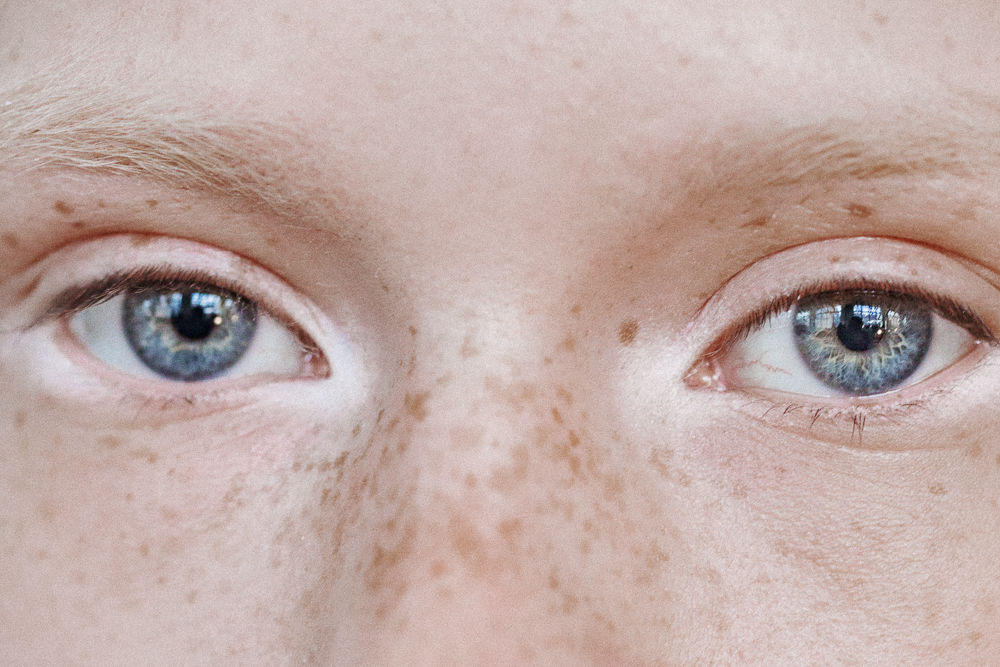 What Actually Works For Undereyes