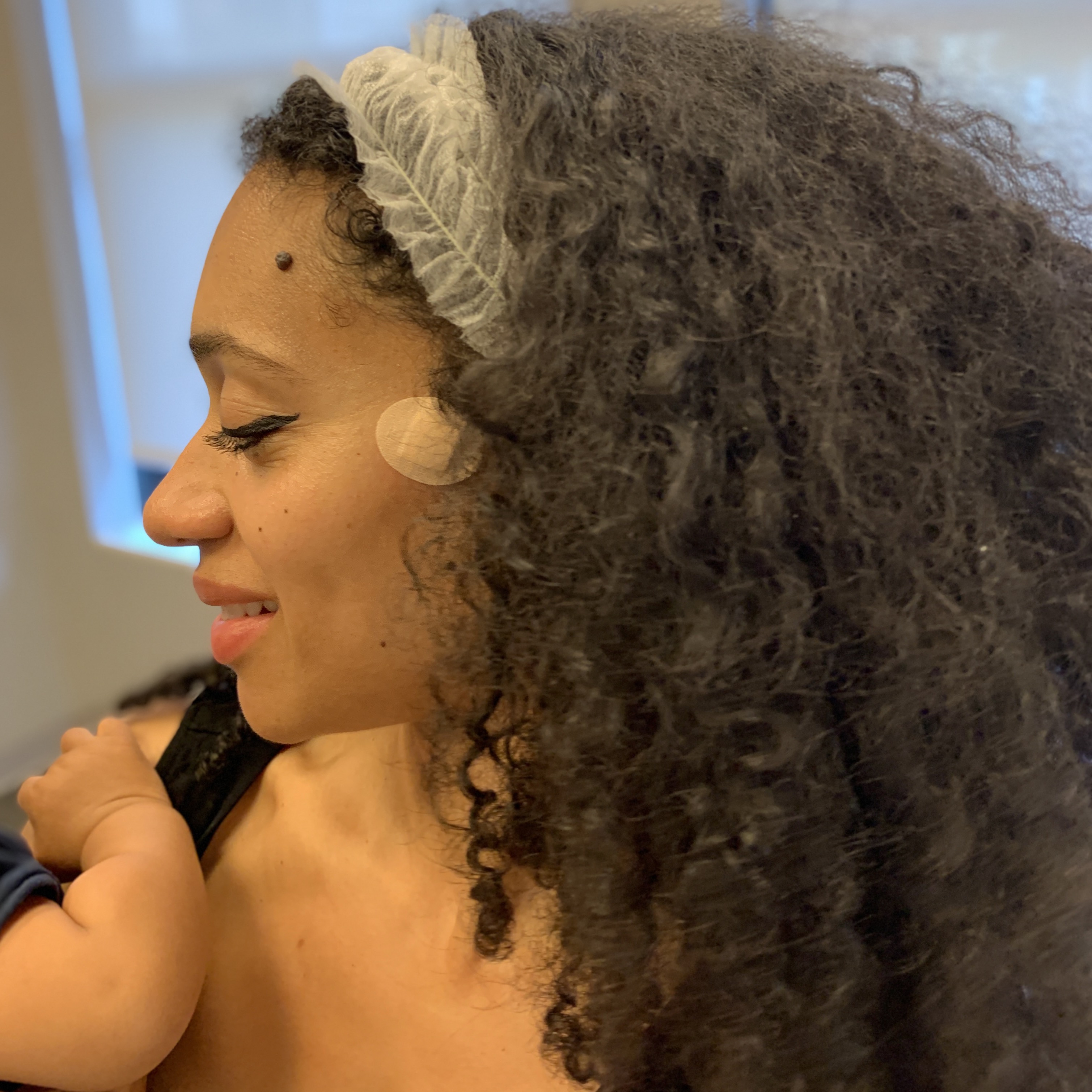 When Pregnancy Skin Changes Get Weird