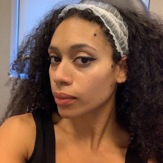 When Pregnancy Skin Changes Get Weird