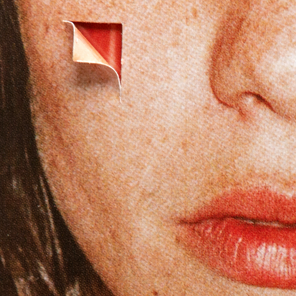 The ITG Guide To Everything Acne