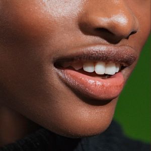 How To Get Rid Of Acne Scars
