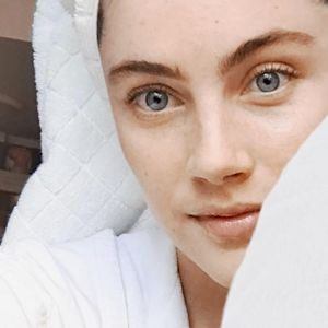 Wow, This Laser Treatment Sounds Amazing