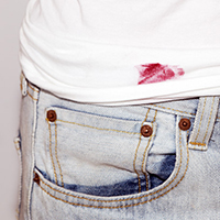 How To Get Lipstick Out Of Anything