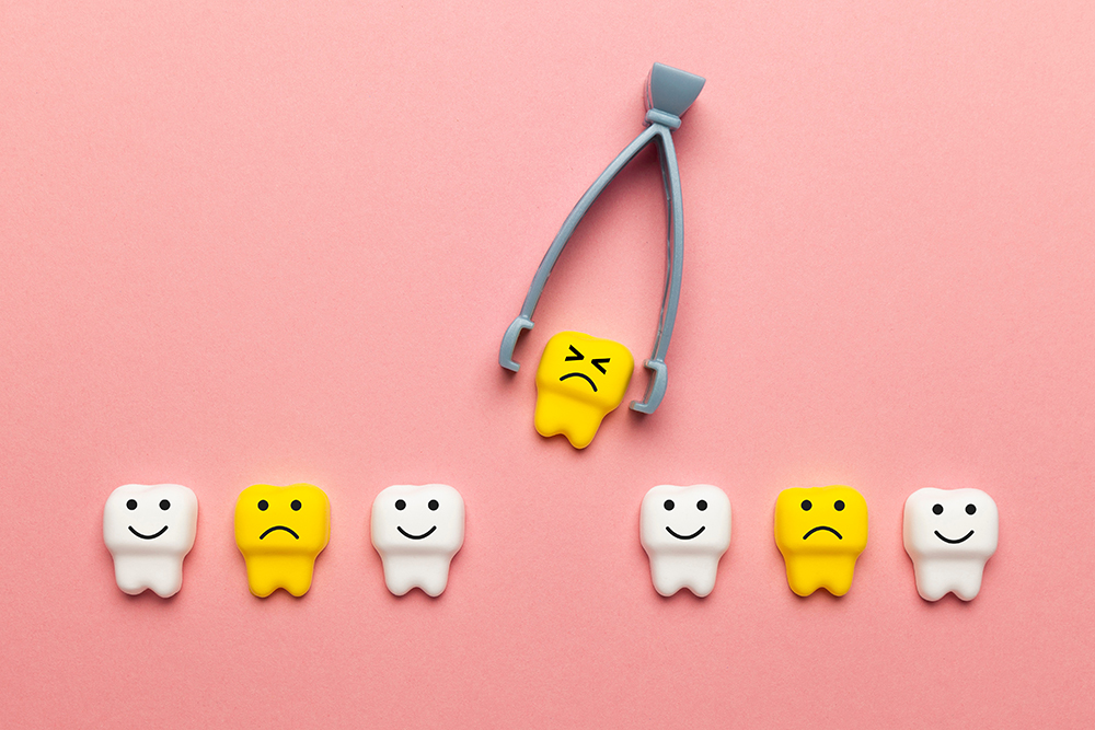 Does Guardian Dental Cover Wisdom Teeth Extraction?