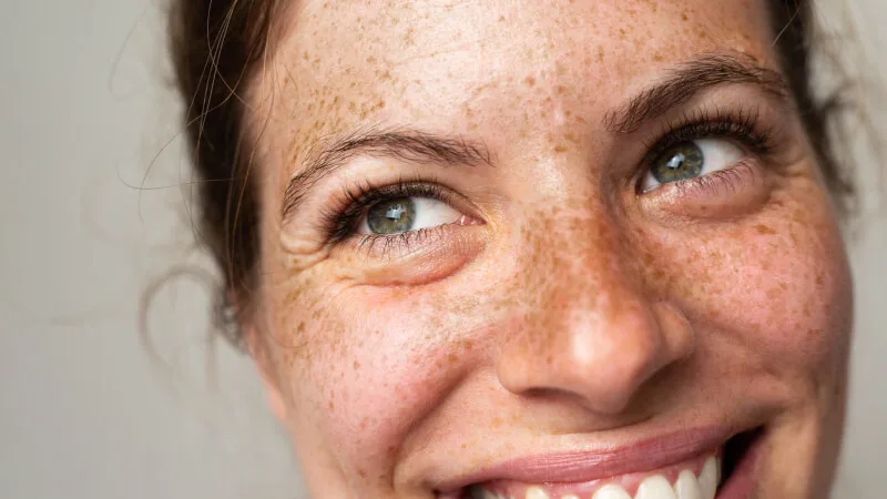 How dental insurance works - Portrait of woman with freckles