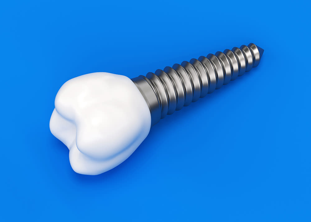 The cost of dental implants can be substantial but dental insurance can help you cover the costs.